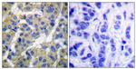 Phospho-Cytokeratin 8 (Ser73) Antibody in Immunohistochemistry (Paraffin) (IHC (P))