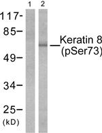 Phospho-Cytokeratin 8 (Ser73) Antibody in Western Blot (WB)