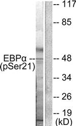 Phospho-C/EBP alpha (Ser21) Antibody in Western Blot (WB)