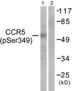 Phospho-CCR5 (Ser349) Antibody in Western Blot (WB)