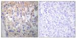 Phospho-Fyn (Tyr530) Antibody in Immunohistochemistry (Paraffin) (IHC (P))