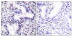 Phospho-Ku80 (Thr714) Antibody in Immunohistochemistry (Paraffin) (IHC (P))