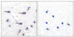 Phospho-MARCKS (Ser163) Antibody in Immunohistochemistry (Paraffin) (IHC (P))