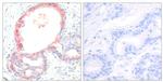 Phospho-c-Rel (Ser503) Antibody in Immunohistochemistry (Paraffin) (IHC (P))