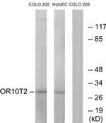 OR10T2 Antibody in Western Blot (WB)