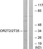 OR2T2/OR2T35 Antibody in Western Blot (WB)