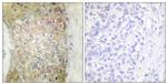 HSP20 Antibody in Immunohistochemistry (Paraffin) (IHC (P))