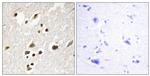 Phospho-IRF3 (Ser385) Antibody in Immunohistochemistry (Paraffin) (IHC (P))