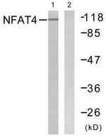 NFATC3 Antibody in Western Blot (WB)