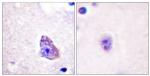 Phospho-p70 S6 Kinase (Thr229) Antibody in Immunohistochemistry (Paraffin) (IHC (P))