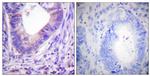 PKA alpha/beta Antibody in Immunohistochemistry (Paraffin) (IHC (P))