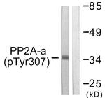 Phospho-PP2A alpha (Tyr307) Antibody in Western Blot (WB)