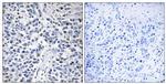 RAD9 Antibody in Immunohistochemistry (Paraffin) (IHC (P))