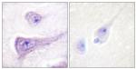 Phospho-WASP (Tyr290) Antibody in Immunohistochemistry (Paraffin) (IHC (P))