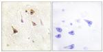 WAVE1 Antibody in Immunohistochemistry (Paraffin) (IHC (P))