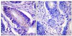 Phospho-eIF4B (Ser422) Antibody in Immunohistochemistry (Paraffin) (IHC (P))