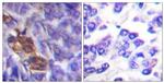 MSK1 Antibody in Immunohistochemistry (Paraffin) (IHC (P))