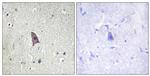 Phospho-TEK (Tyr1102) Antibody in Immunohistochemistry (Paraffin) (IHC (P))