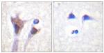 Phospho-14-3-3 zeta (Thr232) Antibody in Immunohistochemistry (Paraffin) (IHC (P))