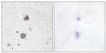 Phospho-Aquaporin 2 (Ser256) Antibody in Immunohistochemistry (Paraffin) (IHC (P))