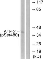 Phospho-ATF2 (Ser480) Antibody in Western Blot (WB)