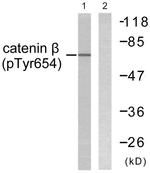 Phospho-beta Catenin (Tyr654) Antibody in Western Blot (WB)