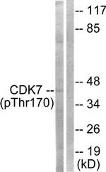 Phospho-CDK7 (Thr170) Antibody in Western Blot (WB)