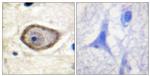 Phospho-CD142 (Ser290) Antibody in Immunohistochemistry (Paraffin) (IHC (P))