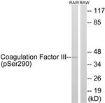 Phospho-CD142 (Ser290) Antibody in Western Blot (WB)