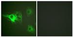 Phospho-Cytokeratin 8 (Ser432) Antibody in Immunocytochemistry (ICC/IF)