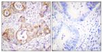 Phospho-Cytokeratin 8 (Ser432) Antibody in Immunohistochemistry (Paraffin) (IHC (P))