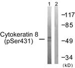 Phospho-Cytokeratin 8 (Ser432) Antibody in Western Blot (WB)