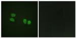 Phospho-DDX5 (Tyr593) Antibody in Immunocytochemistry (ICC/IF)