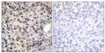 Phospho-DDX5 (Tyr593) Antibody in Immunohistochemistry (Paraffin) (IHC (P))