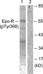 Phospho-EpoR (Tyr368) Antibody in Western Blot (WB)