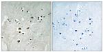 Phospho-ELK3 (Ser357) Antibody in Immunohistochemistry (Paraffin) (IHC (P))