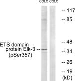 Phospho-ELK3 (Ser357) Antibody in Western Blot (WB)