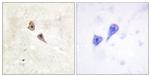 Phospho-IFNAR1 (Tyr466) Antibody in Immunohistochemistry (Paraffin) (IHC (P))