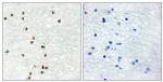 ZIC1/ZIC2/ZIC3 Antibody in Immunohistochemistry (Paraffin) (IHC (P))