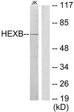 HEXB Antibody in Western Blot (WB)