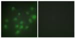 HKR1 Antibody in Immunocytochemistry (ICC/IF)