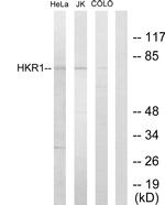 HKR1 Antibody in Western Blot (WB)