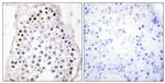 HOXA1/HOXB1/HOXD1 Antibody in Immunohistochemistry (Paraffin) (IHC (P))