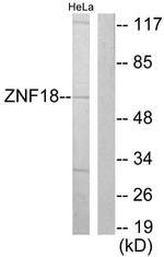 ZNF18 Antibody in Western Blot (WB)