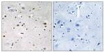 ZNF7 Antibody in Immunohistochemistry (Paraffin) (IHC (P))