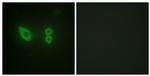 alpha Actinin 2/3 Antibody in Immunocytochemistry (ICC/IF)