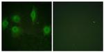 Phospho-IL9R (Ser519) Antibody in Immunocytochemistry (ICC/IF)