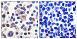 Phospho-IL9R (Ser519) Antibody in Immunohistochemistry (Paraffin) (IHC (P))