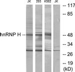 hnRNP H2 Antibody in Western Blot (WB)