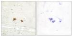 EGR3 Antibody in Immunohistochemistry (Paraffin) (IHC (P))